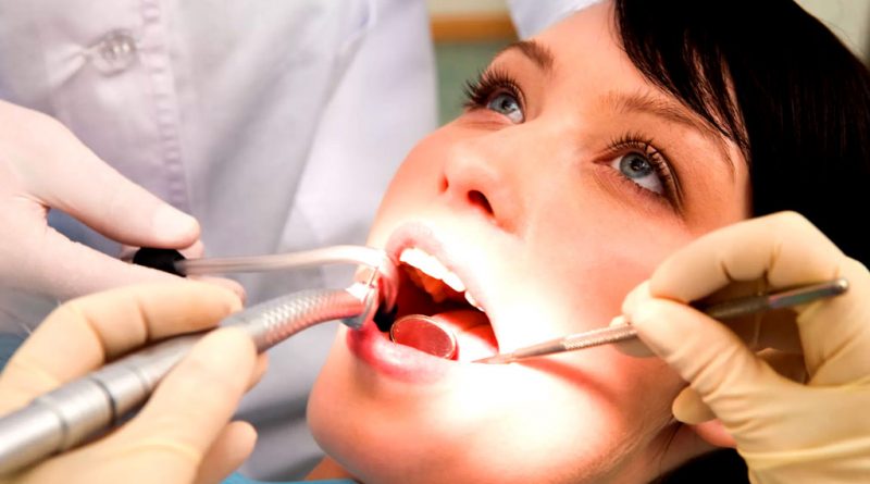 kanal tedavisi, diş kanalı tedavisi, diş kanalı, dişe kanal açma,